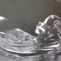 QUESTIONS SUR L'ECHOGRAPHIE